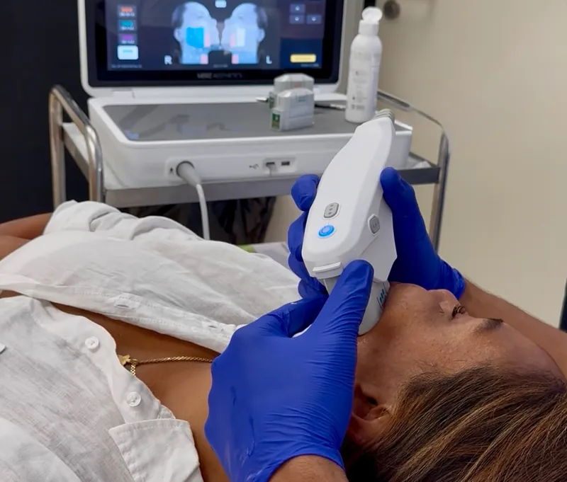 Sesión de Ultherapy PRIME en la cabina de Estetikap Málaga con el equipo de ultrasonido microfocalizado al fondo.